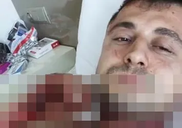 Facebook canlı yayınında jiletle boğazını kesti