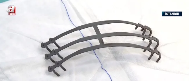 Türkiye’nin sağlıkta geldiği nokta! 18 cm tümör temizlendi protez kaburga takıldı
