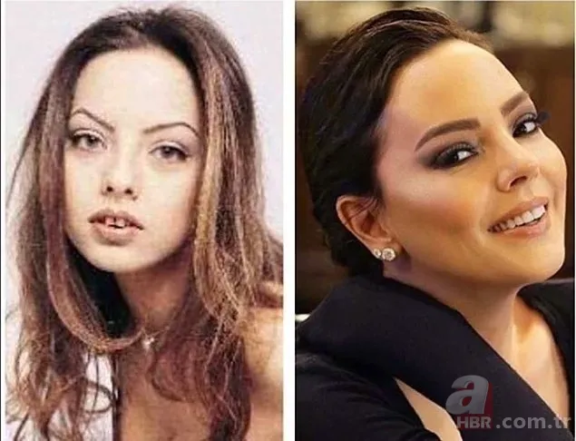 Pınar Dilşeker görenleri şoke etti! Yaptırdığı estetiklerle öyle bir hale geldi ki tanımak imkansız 13