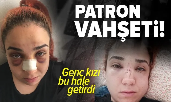 İzmir Karşıyaka'da patron vahşeti! 23 yaşındaki genç kızı bu hale getirdi