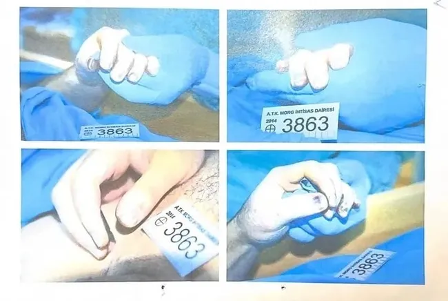 Garipoğlu’nun otopsi fotoğrafları | Garipoğlu’nun mezarı açılır mı? Soruşturmaya nasıl yansır?