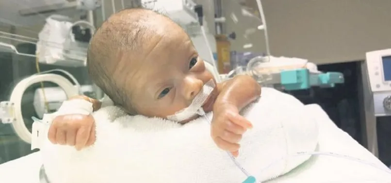 600 gram doğdu hayata tutundu
