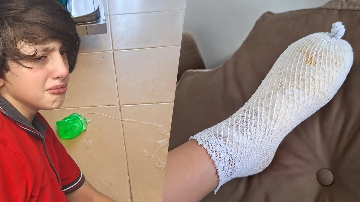 Oyuncak bir anda patladı! 11 yaşındaki Furkan’ın ayağında 2’nci derece yanık oluştu