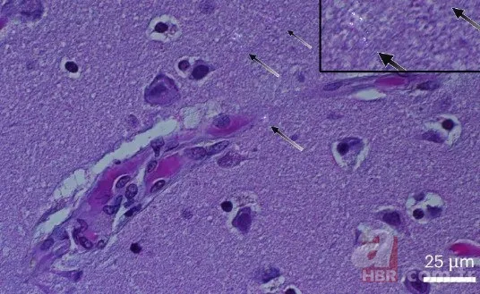 İnsan beynini bekleyen büyük tehlike! Plastikle doluyor... 1