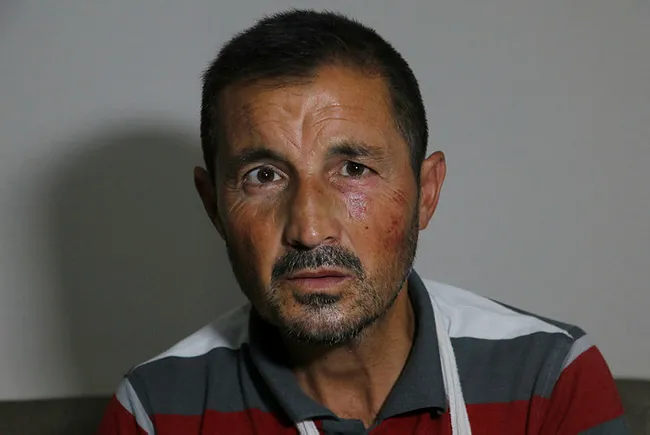 Adana’da işitme engelli adama cadde ortasında feci dayak - 1