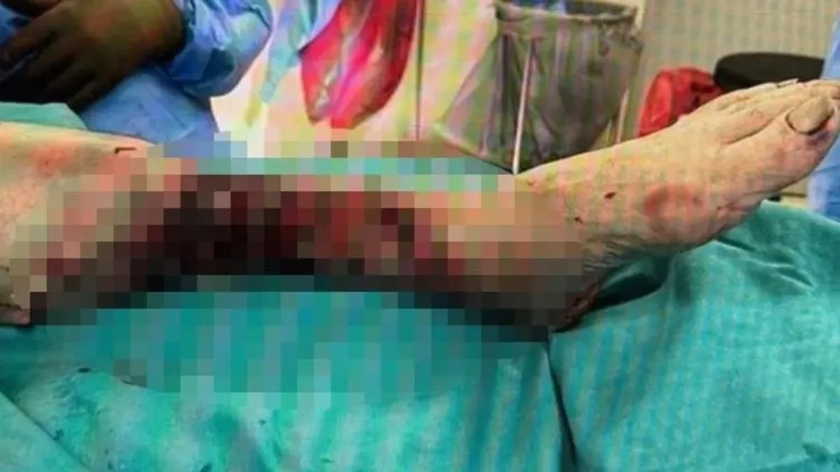 İstanbul'da pitbull vahşeti! Yaşlı adam bacağını kaybetti