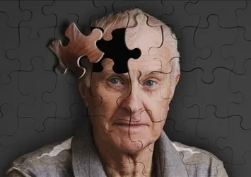 Alzheimer hastalığı nedir belirtileri nelerdir?