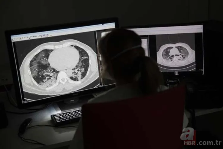 Hastanede yaşananlar tüyler ürpertti! İşte gün gün corona virüs kabusu 21