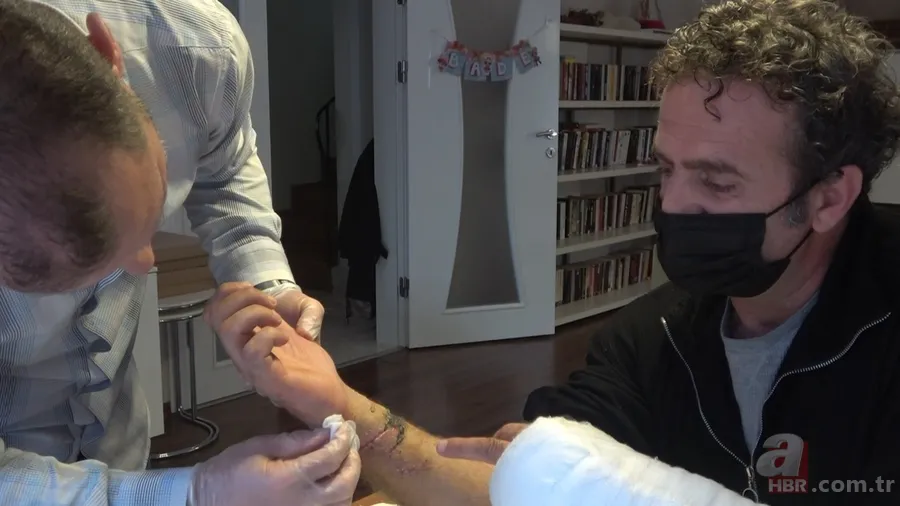 Pitbull saldırısında ölümden döndü! Canını kurtarmak için köpeği camdan attı! O anlar kamerada 6