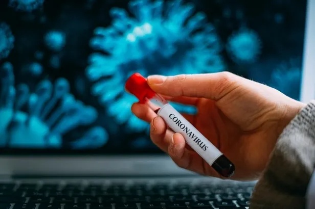 Turkovac randevu alma: Turkovac aşı randevu alma başladı mı, ne zaman? Turkovac aşı randevusu hangi tarihte alınacak?