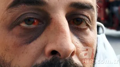 Bursa’da dehşete düşüren olay! Önce otomobille çarptılar sonra öldüresiye dövdüler