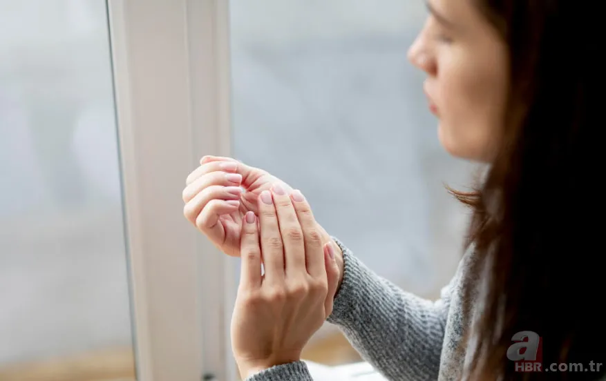 Soğuk hava cildi kurutuyor: İşte çatlayan elleri onaran 4 etkili bakım yöntemi 1