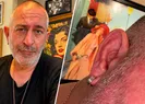 Cem Yılmazdan kulak çizgisi esprisi