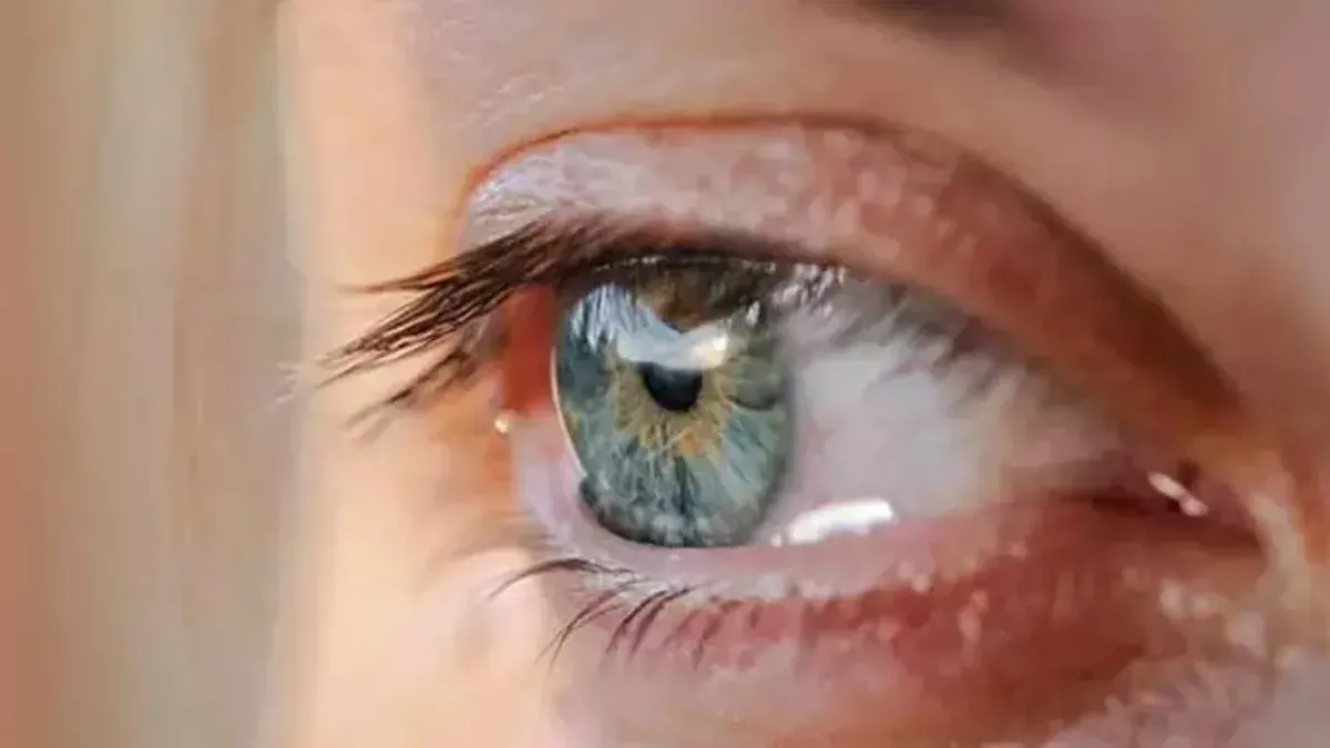 Uzmanı açıkladı! Göz nezlesinden korunma yolları!
