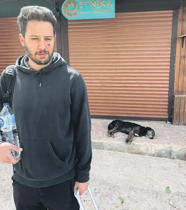 Son dakika: Oyuncu Tuan Tunalı sevdiği sokak köpeğinin saldırısına uğradı! Neredeyse gözünden oluyordu - 1