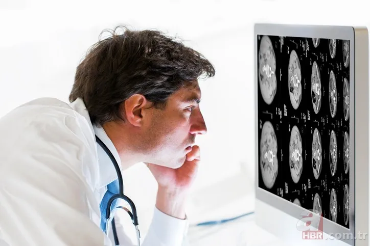 Böbrekleri tüketen 10 neden (Diyalize mahkum olmamak için dikkat) 9