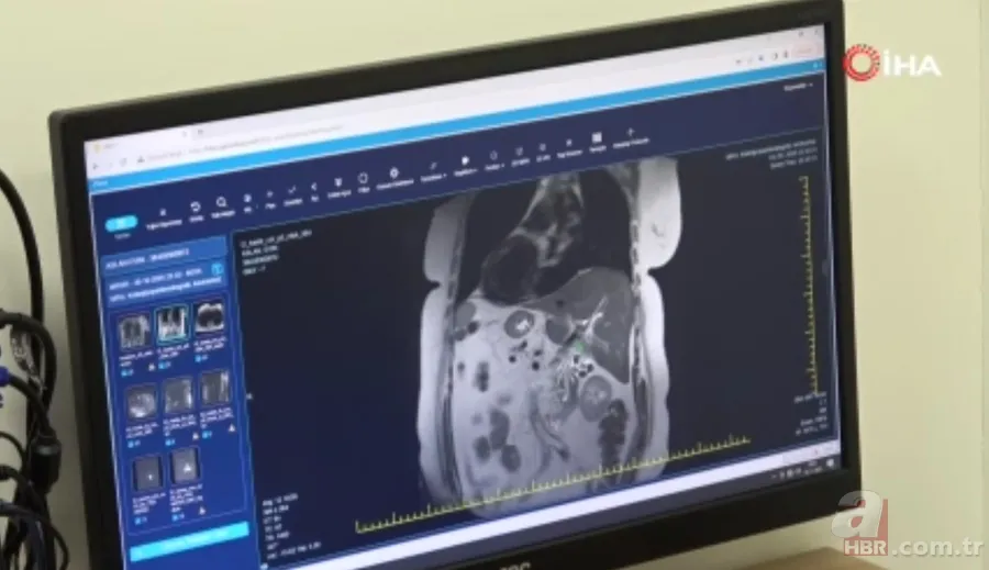 İnanılmaz! Doktorları bile hayrete düşürdü: 66 yıldır iç organları tersine çalışıyor 12