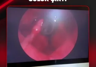 BOĞAZINDAN SÜLÜK ÇIKTI