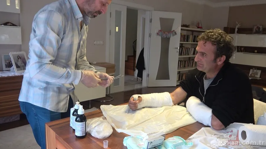 Pitbull saldırısında ölümden döndü! Canını kurtarmak için köpeği camdan attı! O anlar kamerada 5