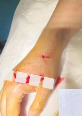 Harbiye Açıkhava’da havai fişek dehşeti! Göksel konserine gelenler kanlar içinde kaldı 6