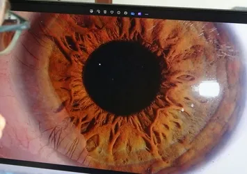 Sivas'ta “İris” fotoğrafçılığı ilgi görüyor