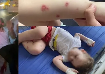 1,5 yaşındaki bebeğe işkence! Vicdansız babaya meydan dayağı