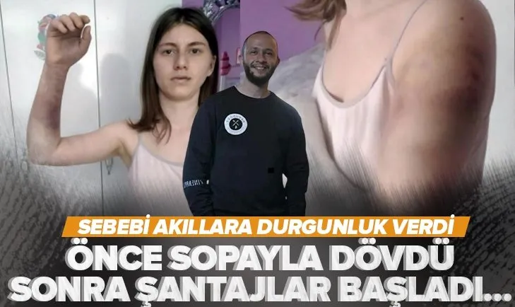 Zeynep Çetinkaya’yı beyzbol sopasıyla öldüresiye döven sevgilisinden ikinci darbe: Fotoğraflarını her yere yayarım