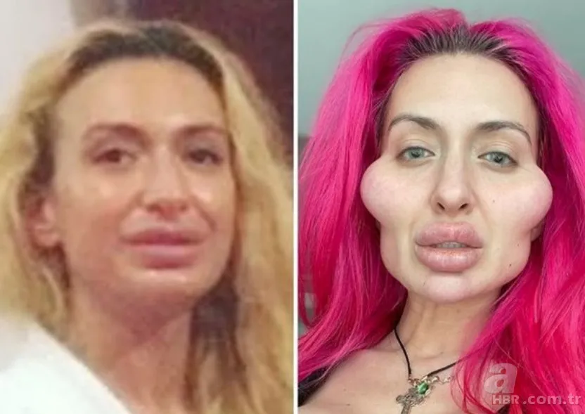 Fatih’te estetik yaptıran Bulgar modelin hayatı kabusa döndü! ‘Örümcek ağı’ operasyonu bakın ne hale getirdi? 25