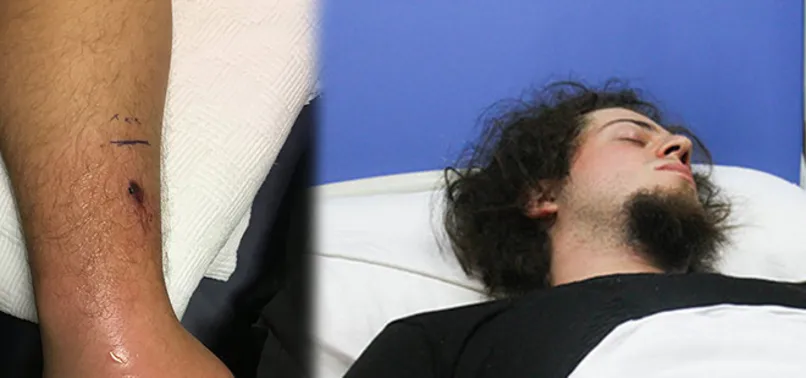 Aref ayağa kalkamıyor, tüp tüp panzehir veriliyor