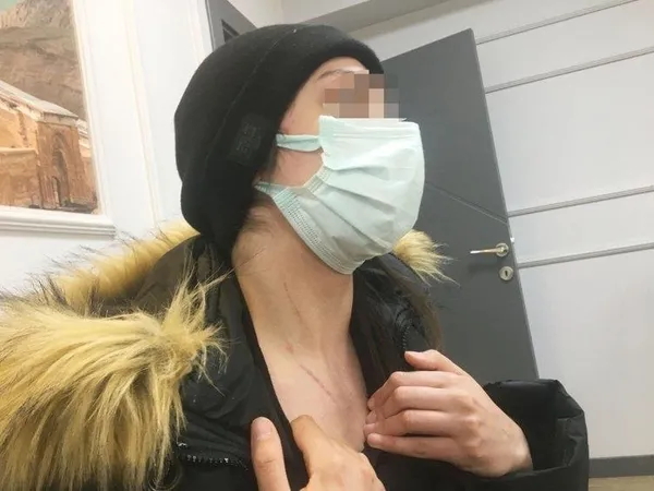 1650168809721.jpeg Rezidansta işkence! 'Korkudan dışarı çıkamıyorum' - 4