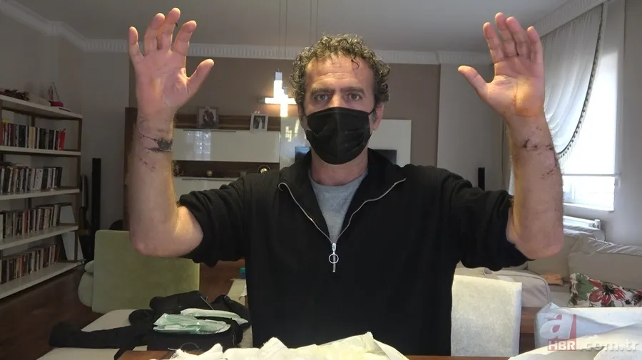 Pitbull saldırısında ölümden döndü! Canını kurtarmak için köpeği camdan attı! O anlar kamerada 8