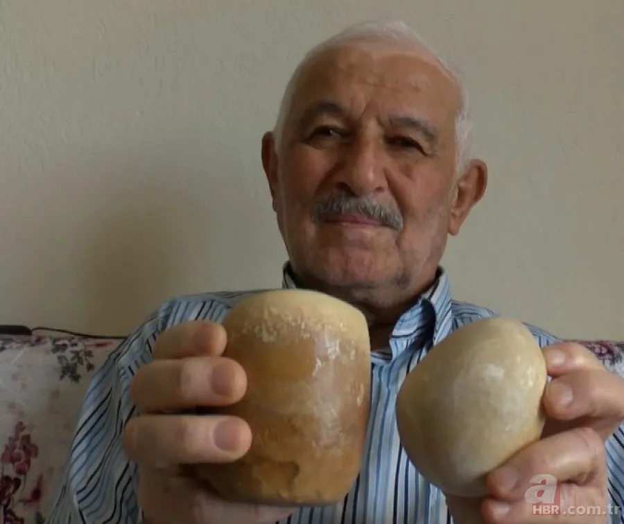 Karın bölgesinde şişlik ve halsizlik şikayetiyle doktora gitti! Karnından çıkanlar şoke etti 14