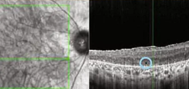 Doktorlardan mucizevi tedavi! 40 yıl sonra ilk defa görüldü