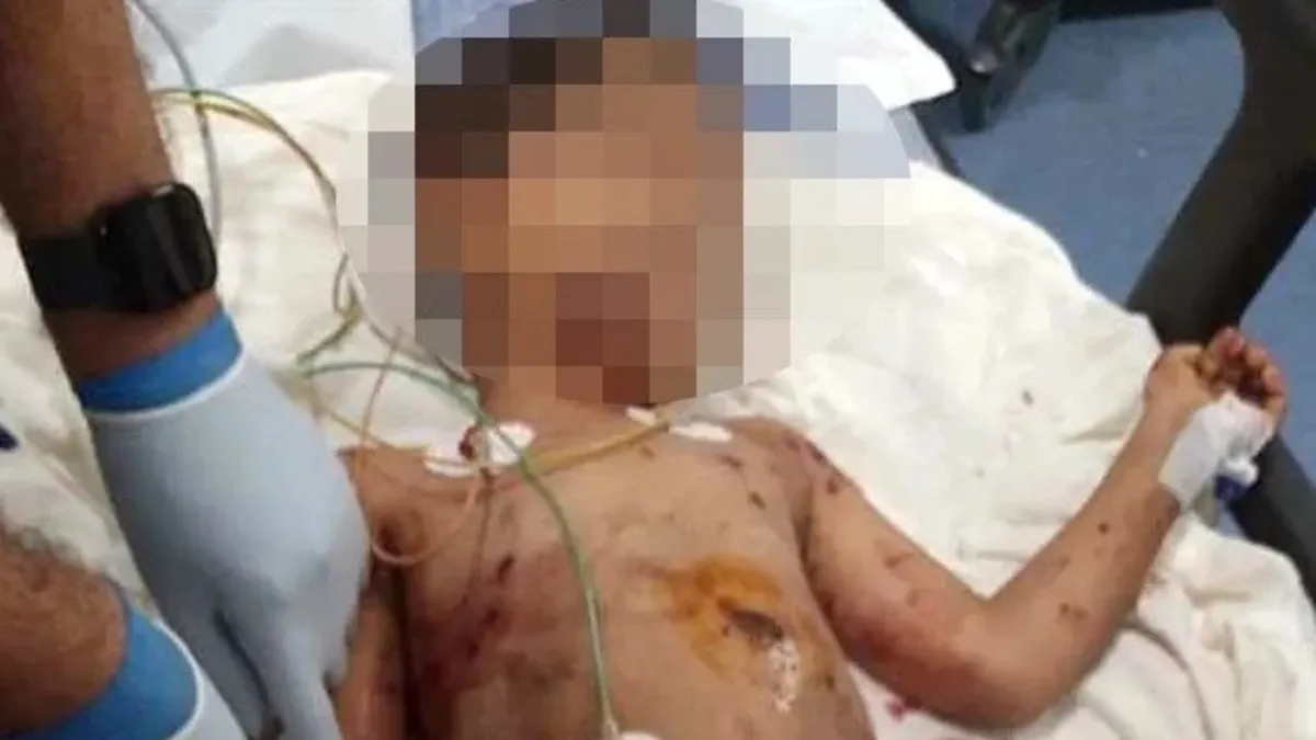 Adana'da sokak köpeği dehşeti! Küçük çocuğa yalnız kaldığı an 5 köpek birden saldırdı! Ağır yaralı...