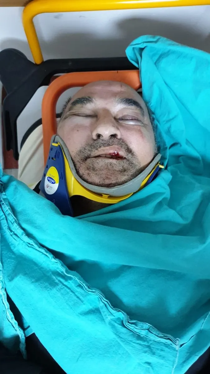 kusadasi-belediyesi-icin-usulsuzluk-iddiasinda-bulunan-gazeteci-yazar-ergun-poyraza-darp-pkk-kck-detayi-1649715799977.jpg Kuşadası Belediyesi için usulsüzlük iddiasında bulunan gazeteci-yazar Ergun Poyraz'a darp! PKK-KCK detayı... - 1