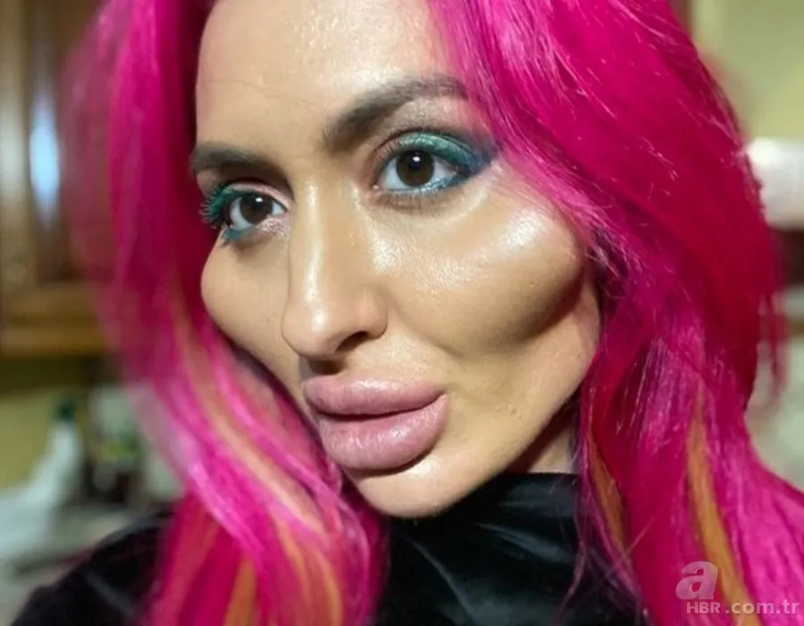 Fatih’te estetik yaptıran Bulgar modelin hayatı kabusa döndü! ‘Örümcek ağı’ operasyonu bakın ne hale getirdi? 16