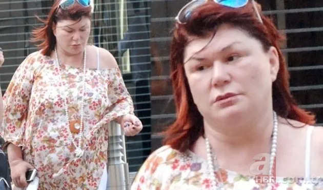 Fazla kilolarından kurtulunca hayatları değişen ünlüler 13