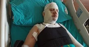 Depremzede eski eşini kaynar suyla yaktı!