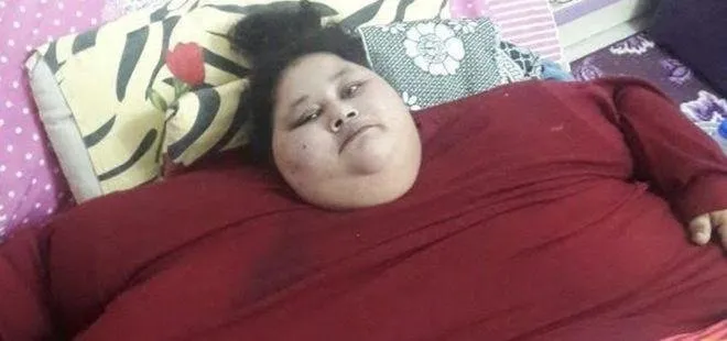 Dünyanın en şişman kadını 250 kilo verdi