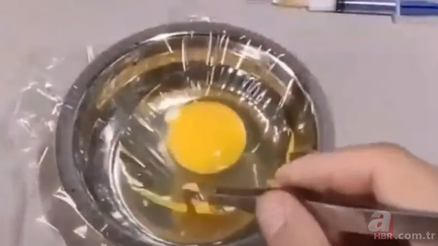 İşte civcivin yumurta içindeki gelişimi 🐣 İğne ile enjekte etti gün gün görüntüledi 🥚 12