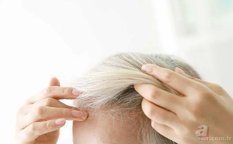 Kaşınan ve kepeklenen saçınız varsa dikkat! Bu yöntemle hem rahatlayacak hem de saçınızı uzatacaksınız 7