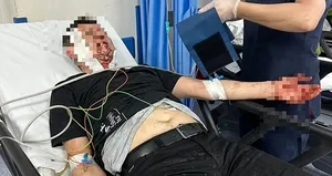 Bursa’da başıboş köpek dehşeti kamerada!