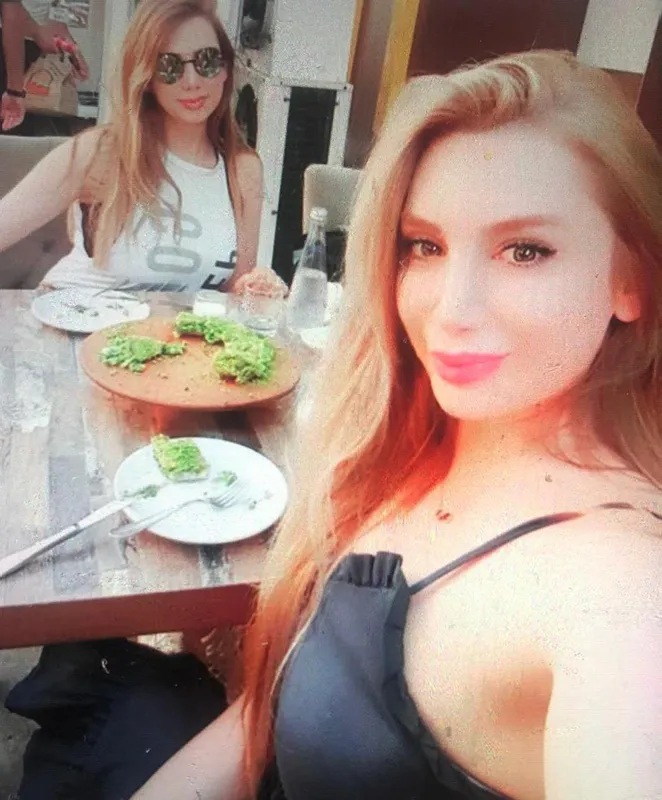 Kübra Boyraz’ın ölümünde şaşırtan karar! Botoks sonrası canından olmuştu - 2