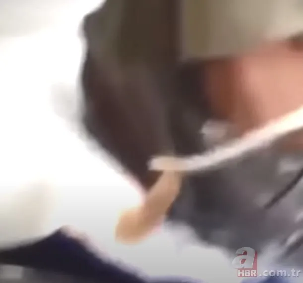 Çenesindeki şişliği sivilce zannetti ama gerçek bambaşka çıktı! Dehşete düşüren olay