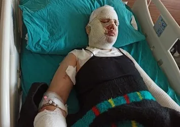 Hatay’da vahşet! Depremzede eski eşini kaynar suyla yaktı | İfadesi kan dondurdu