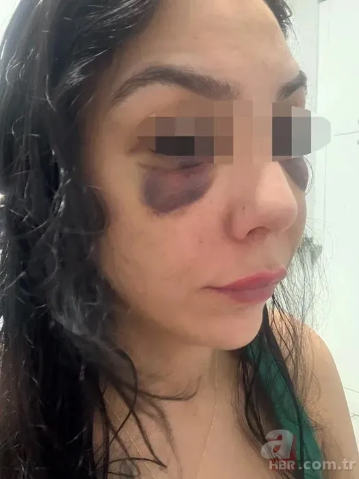 Lisanlı kick boksçudan iş arkadaşına kıskançlık dayağı! 2