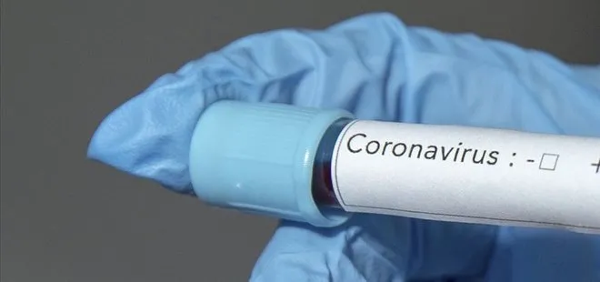 Ermenistan’da ilk koronavirüs vakası