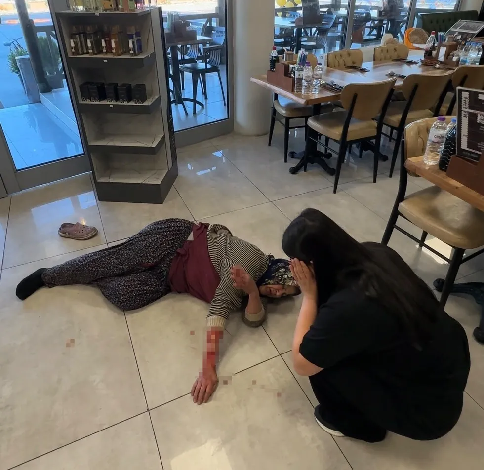 1781436134692.jpeg Afyonkarahisar'daki dinlenme tesisinde vahşet! Başıboş köpek kadının kolunu parçaladı - 1