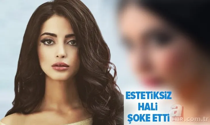 bir zamanlar cukurova nin mujgan i estetiksiz haliyle soke etti iste melike ipek yalova nin degisimi