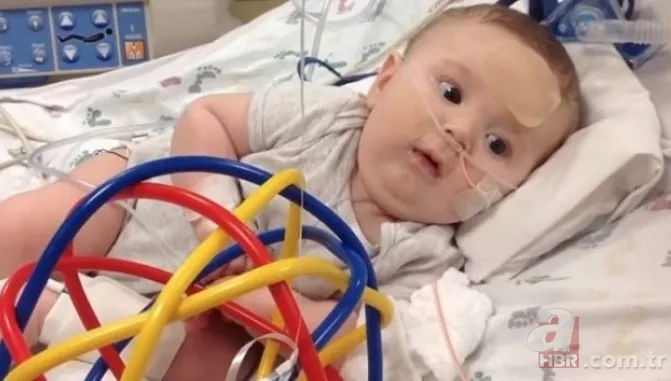 SMA hastalığı nedir, ne zaman ortaya çıkar? SMA teşhisi nasıl konur? Tedavisi, belirtileri, SMA testi... 11